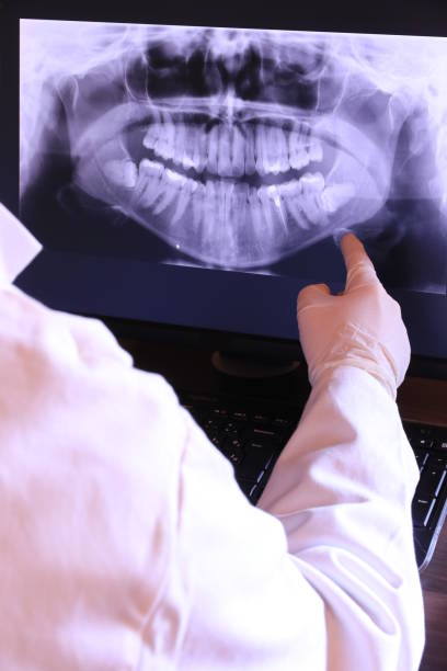 Best Chipped Tooth Repair Near Me  in Glenn Heights, TX