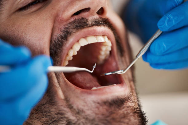 Best Dentist for Tooth Abscess  in Glenn Heights, TX