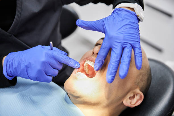 Best Emergency Dental Filling Replacement  in Glenn Heights, TX